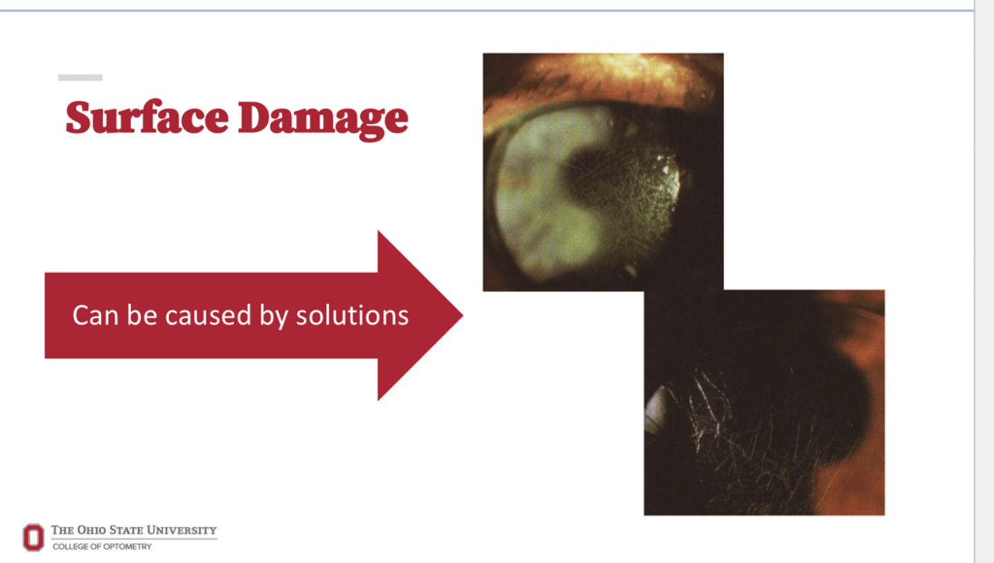 <p>Surface Damage of RGPs (Pic)</p>