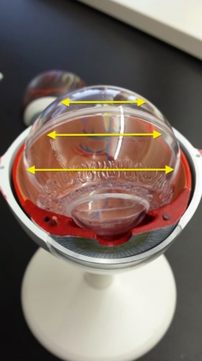 <p>What part of the eye is this?</p>