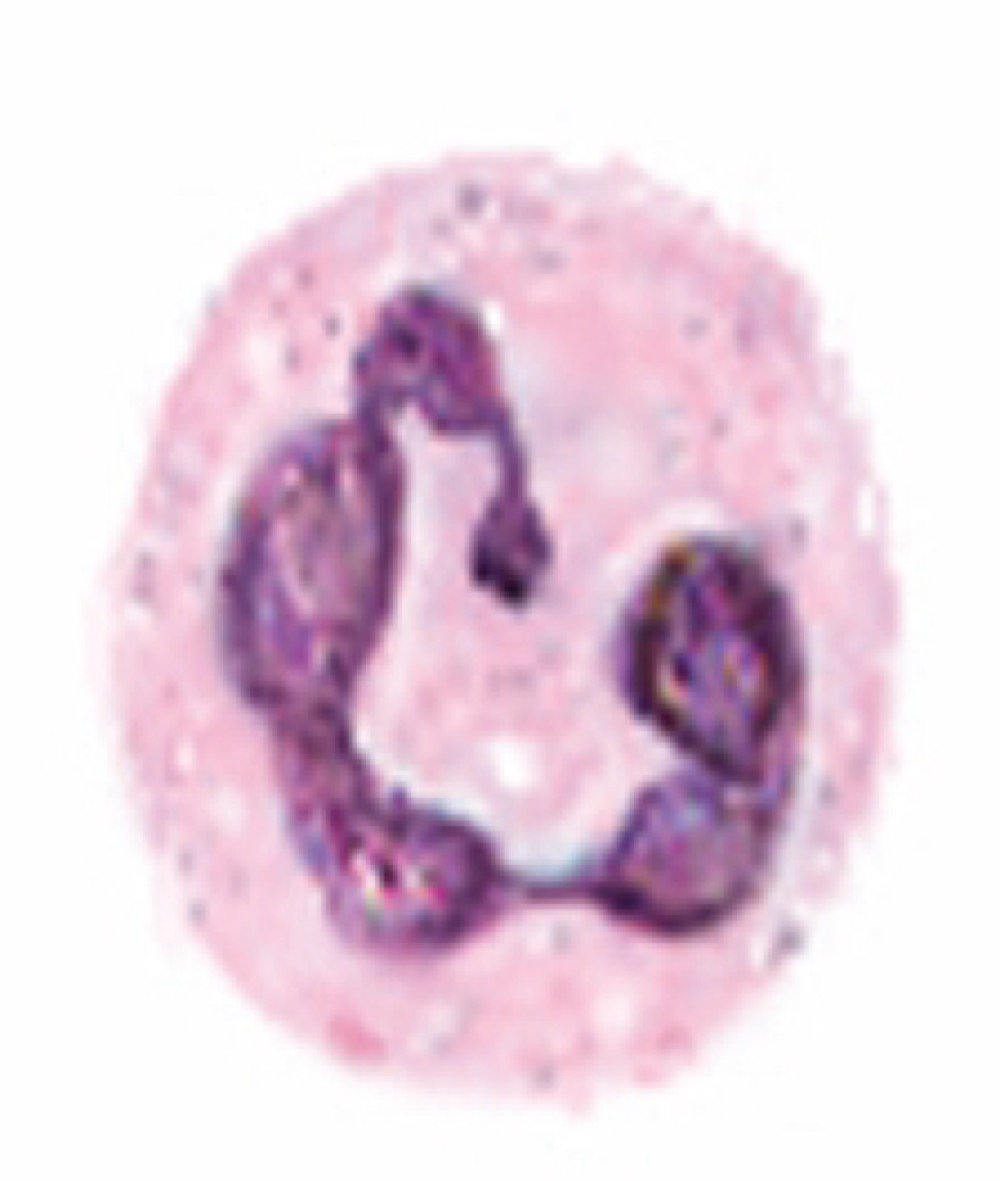 <p>Mature of immature neutrophil?</p>