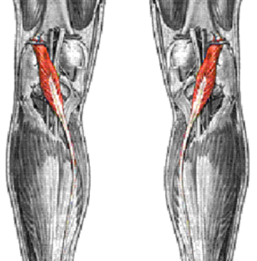 <p>•<strong>Origin</strong>: lateral supracondylar ridge of femur</p><p>•<strong>Insertion</strong>: calcaneus</p><p>•<strong>Innervation</strong>: tibial</p><p>•<strong>Action</strong>: Ankle plantarflexion, Knee flexion</p><p>•<span style="background-color: transparent;"><strong>Notes:</strong> Posterior to the gastrocnemius&nbsp;</span></p>