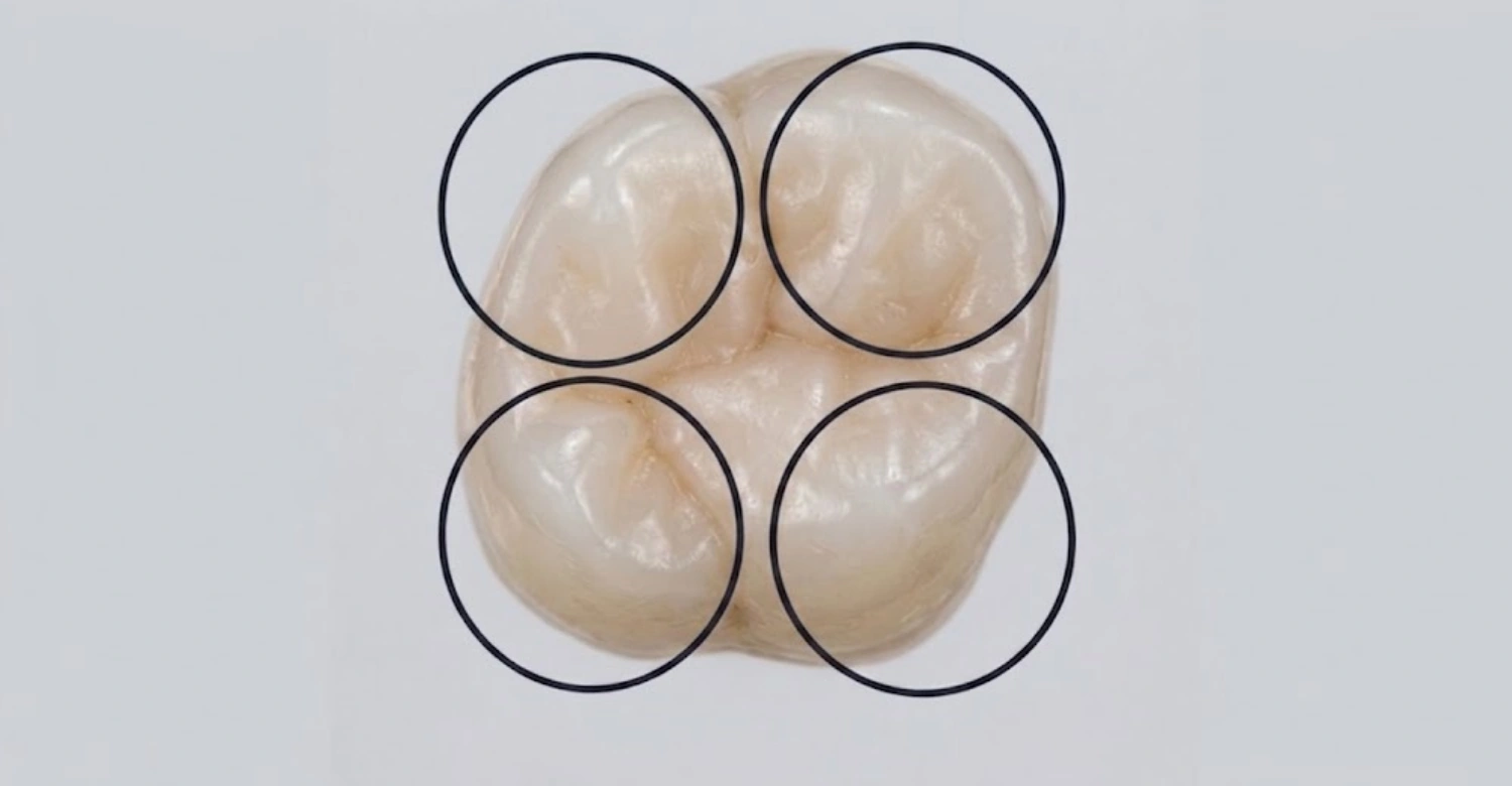 <p>The peeks on the chewing surface of posterior teeth.</p>