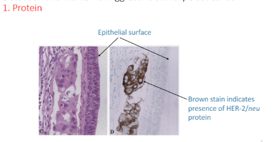 <p>IHC can tells us <strong>IF</strong> the tissue has the protein in a <strong>tissue sample/ biopsy</strong> and <strong>WHERE </strong>it is. Detects a specific protein <strong>within a tissue</strong></p><ul><li><p class="MsoListParagraphCxSpMiddle">(E.g. when investigating the HER-2 gene related to certain cancers the first question is does this tumour contain HER2 protein? The protein is first through immunohistochemistry = Brown staining will detect if the HER2 protein is present)<span>&nbsp;</span></p></li></ul><p class="MsoListParagraphCxSpLast">Also tells us <strong>where </strong>the protein is<strong> located within a tissue</strong> e.g. cell membrane/cytoplasm/nucleus</p>