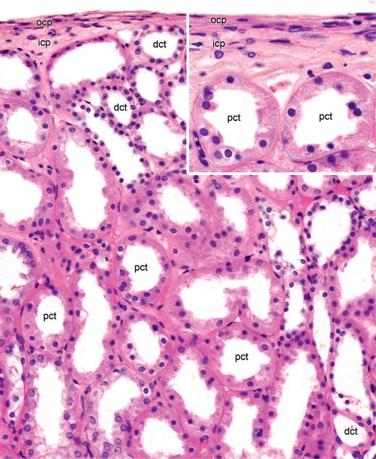 <p>found in:</p><p><span>lining of lung alveoli, blood vessels (endothelium), and serous membranes (mesothelium)</span></p>