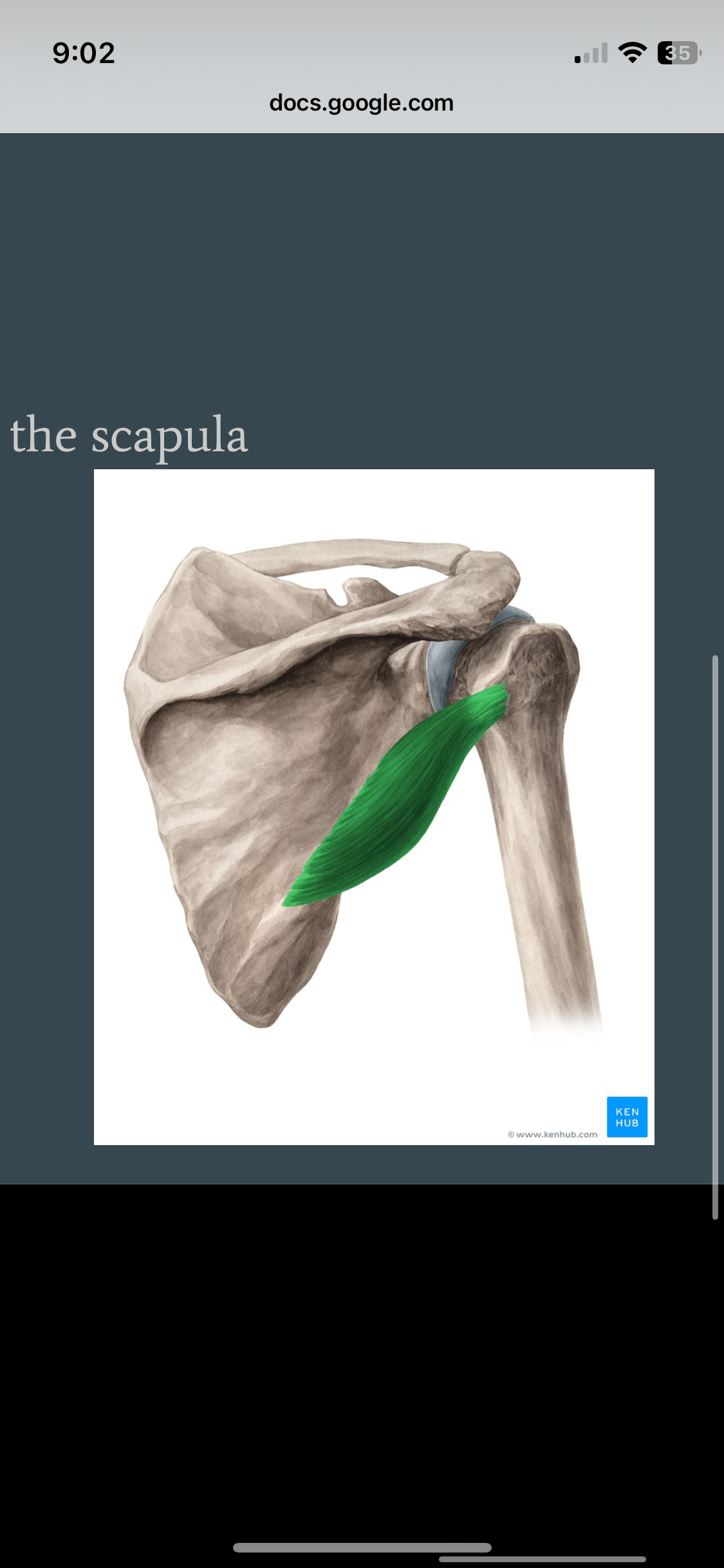 <p>Teres Minor</p>