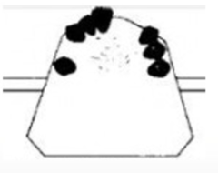 <p>What kennedy classification?</p>