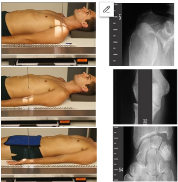 <p>AP shoulder</p><p>»Direct the CR to midshoulder joint</p><p>AP elbow</p><p>»Direct the CR to midelbow joint </p><p>AP wrist</p><p>»Direct the CR to midwrist joint</p>