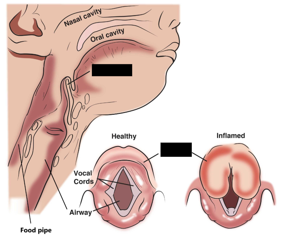 <p><span style="background-color: transparent;">An elastic cartilage flap that closes during swallowing to keep substances from moving into the trachea and air passages.</span></p>