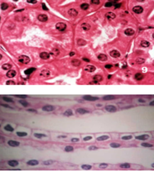 <p>cell shape is square or rounded</p>