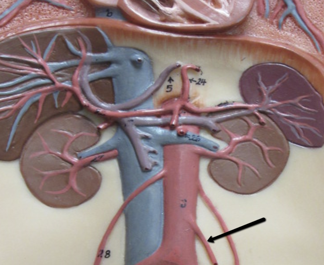 <p><span>Identify the blood vessel indicated by the pointer.</span></p>