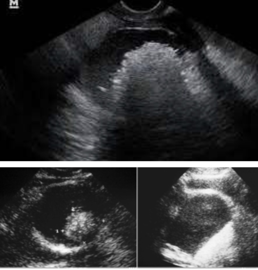 term image