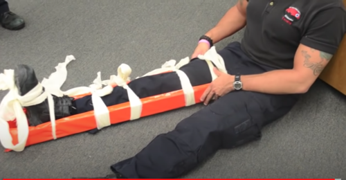 <p>splinting </p>
