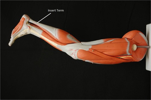 <p>pertaining to the heel</p>