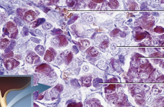 <p>what gland is this</p>