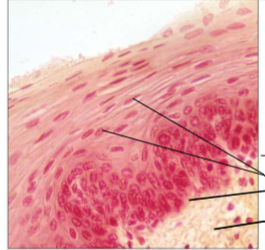 <p>Protects underlying tissues in areas subjected to abrasion</p>