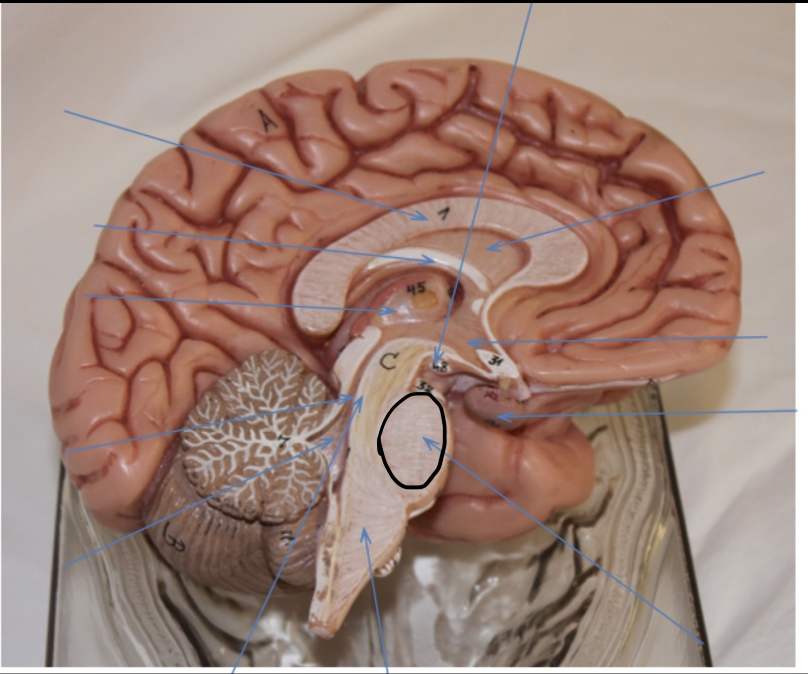 <p>Identify the circled area?</p>