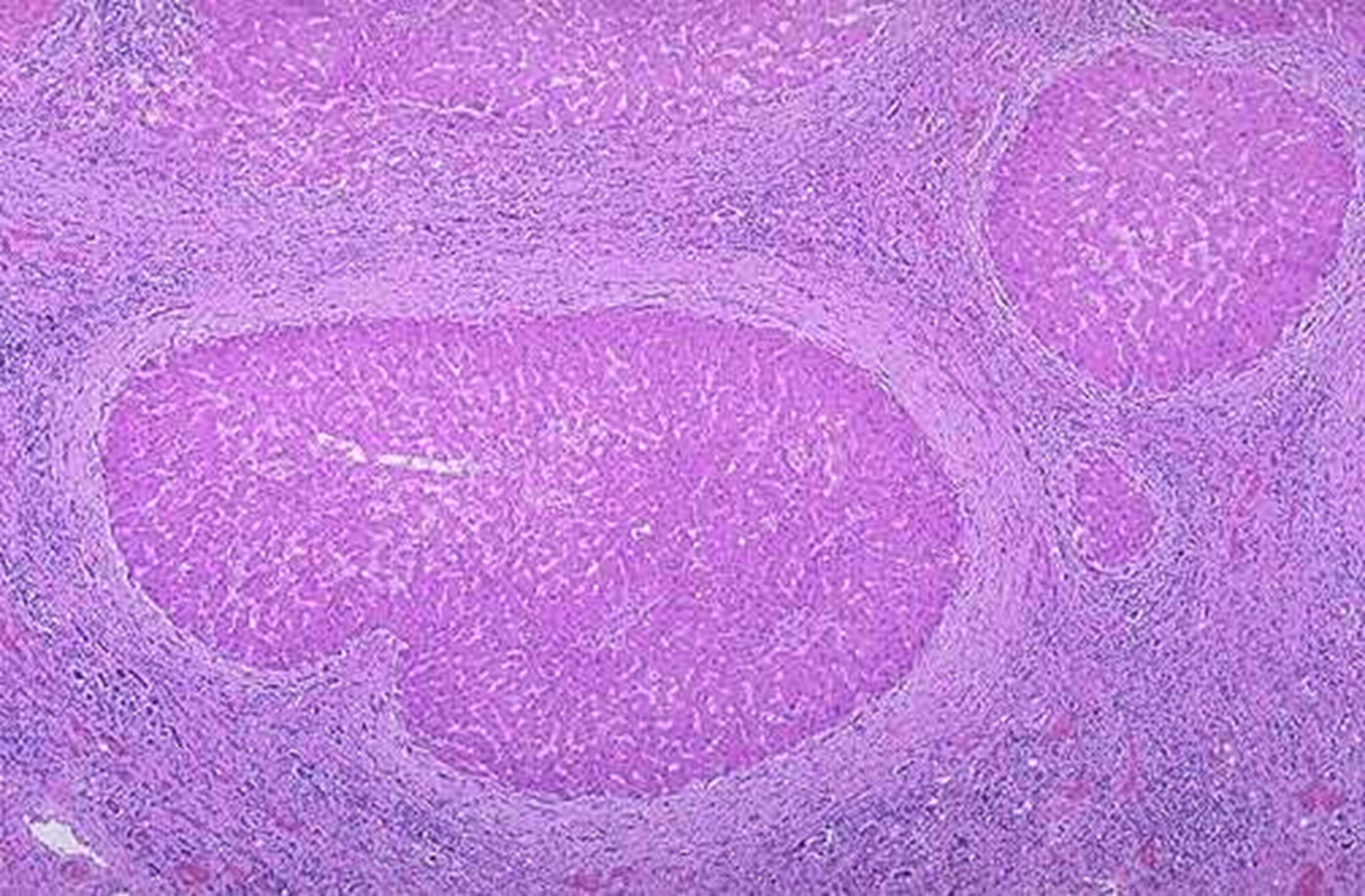 <p>microscopically</p>