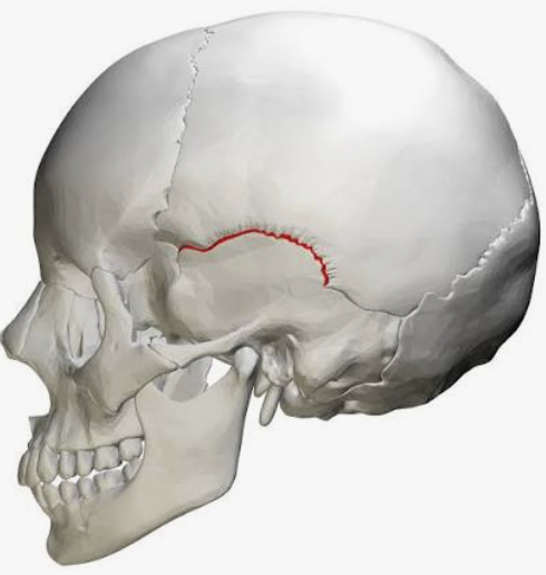 <p>Which suture is this?</p>