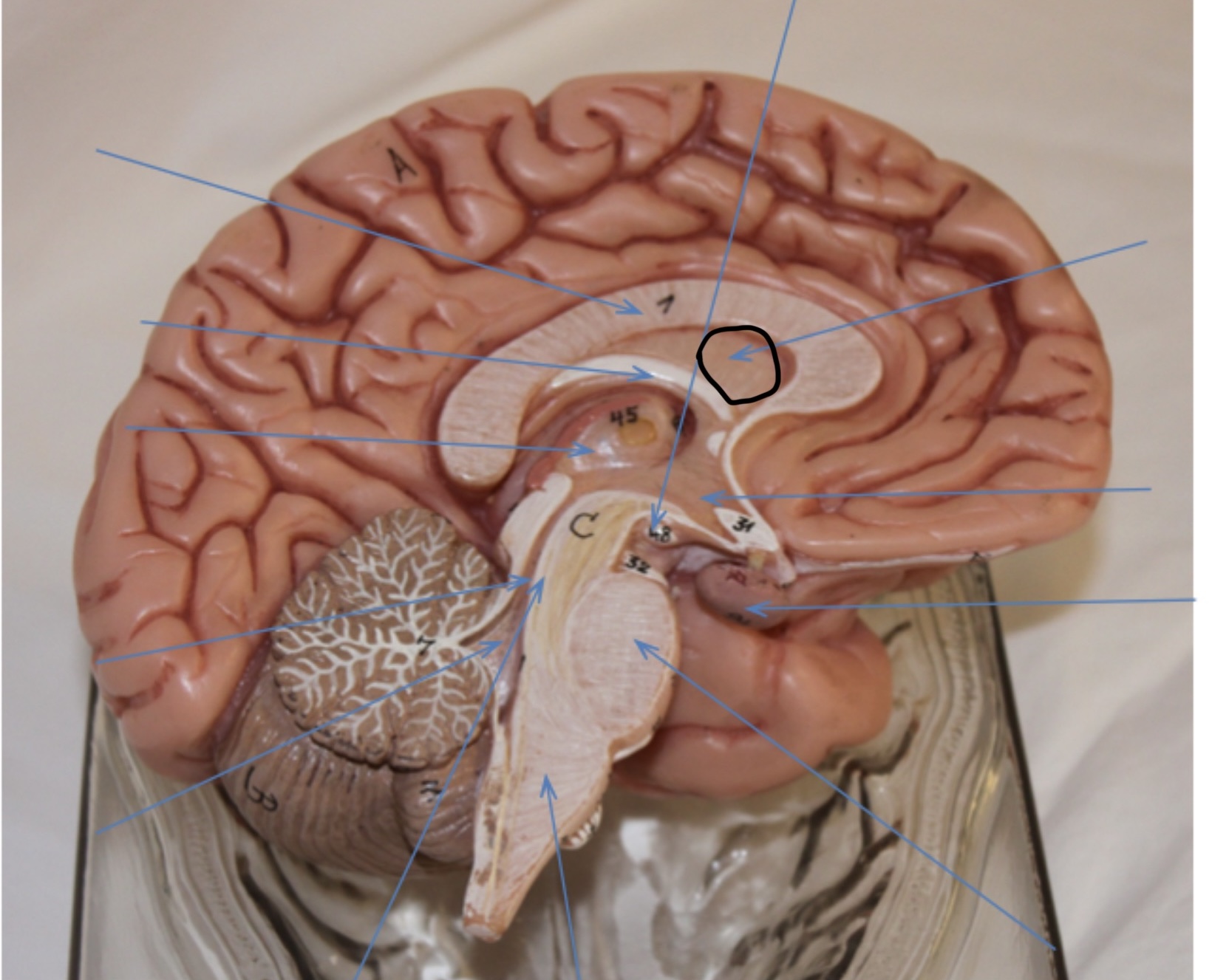 <p>Identify the circled area?</p>