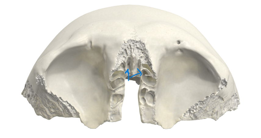 term image