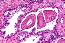<p>give anatomical name, histological classification, and secretion of gland shown</p>