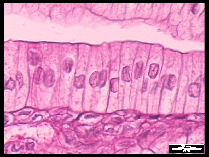 <p><span style="line-height: 21.6px;">Simple columnar epithelium</span></p>