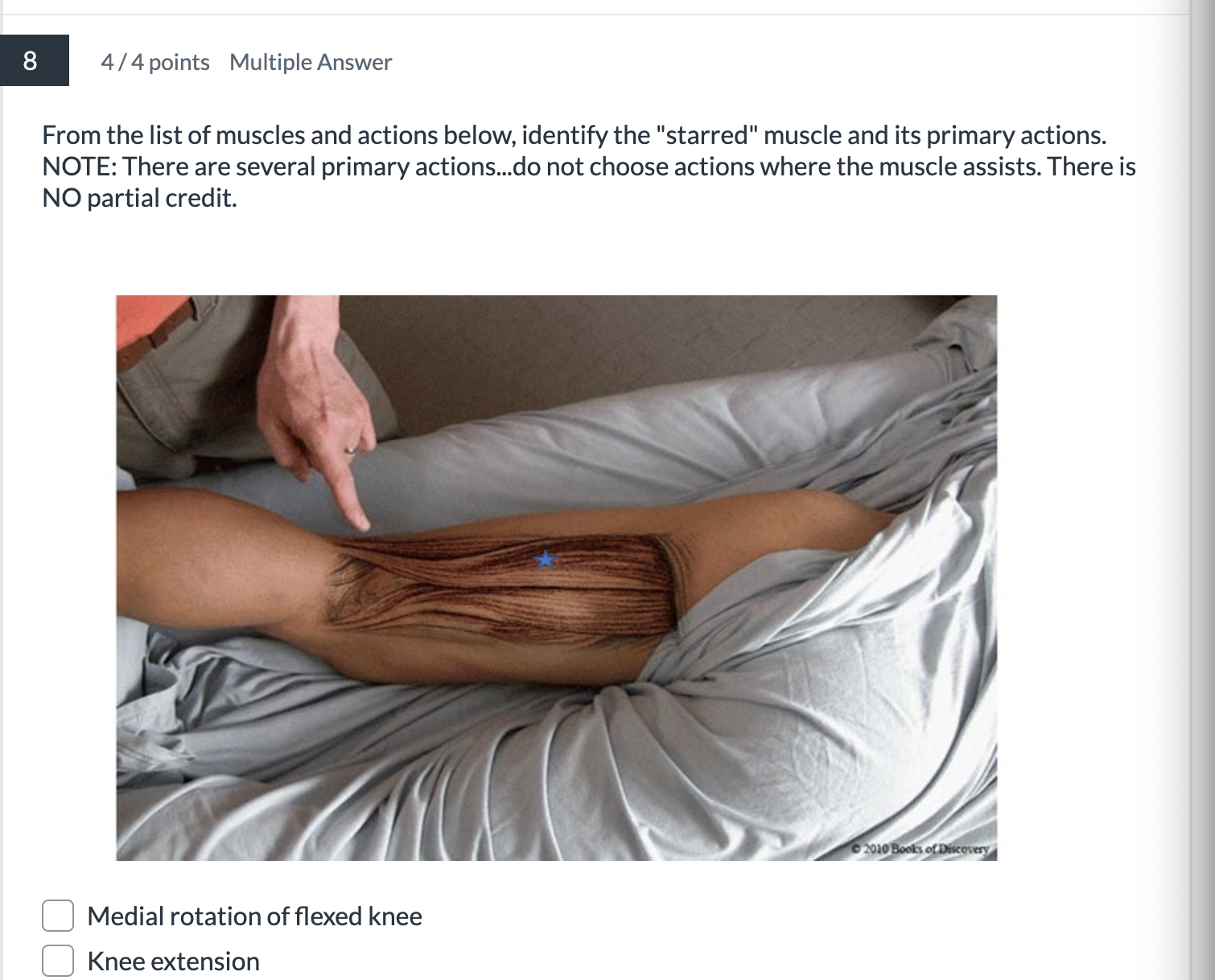 <p><span>From the list of muscles and actions below, identify the "starred" muscle and its primary actions.</span></p>