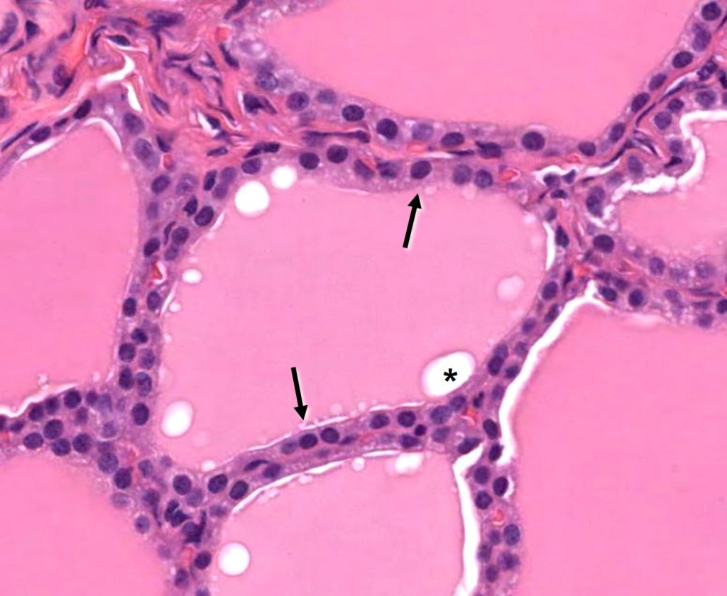 <p>AKA squamous or thin, scale like pattern, squished nucleus</p>
