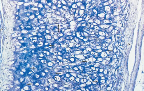 <p>What type of cartilage is this?</p>