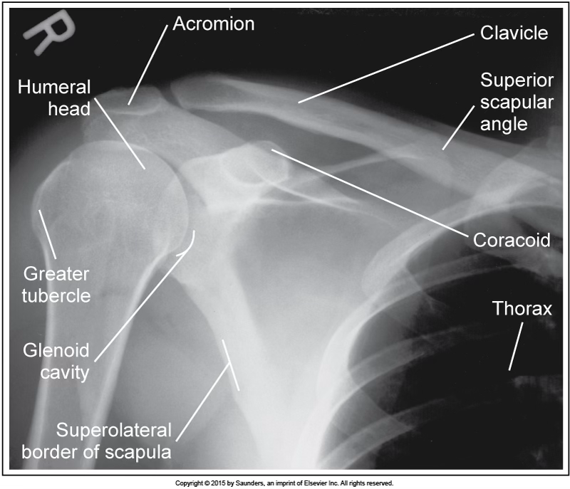 <p>AP neutral shoulder</p>