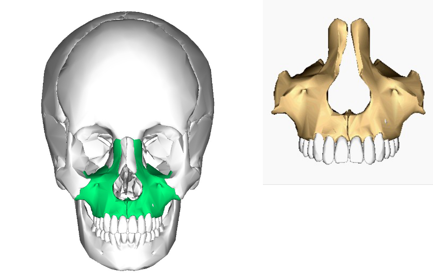 <p>Fused form 1 Maxilla</p>
