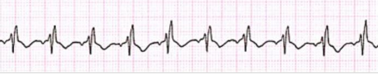 <p>What is this rhythm?</p>