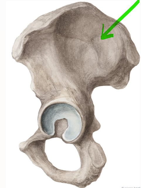 term image