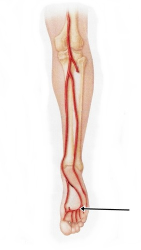 <p>sole of foot </p>
