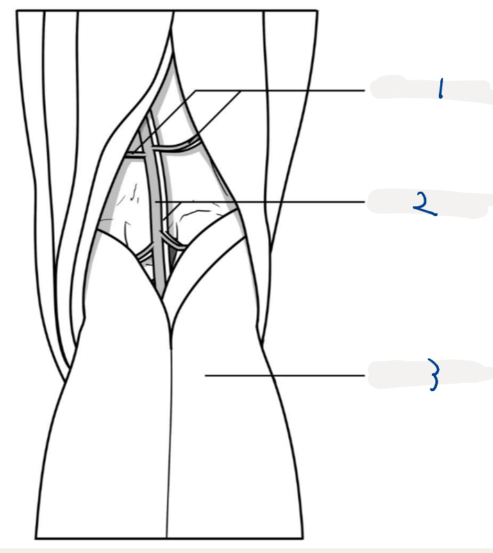 <p>LABEL. What superiorly borders the fossa</p>