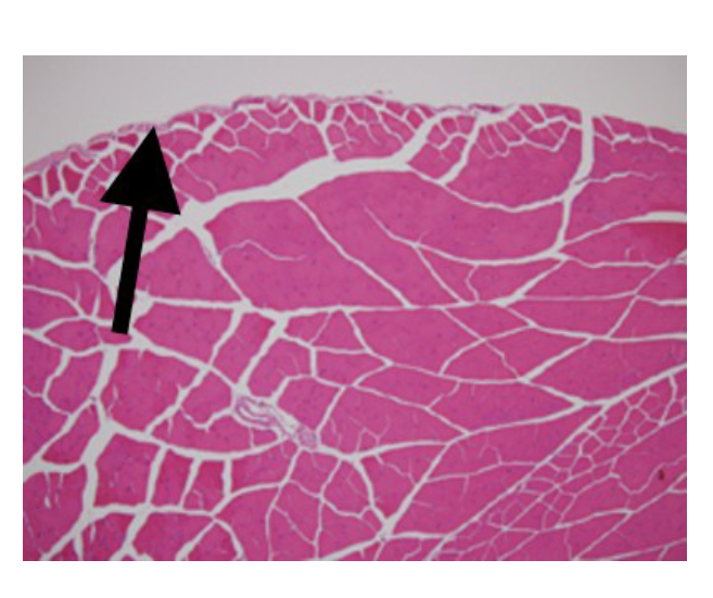<p>connective tissue that surrounds the whole muscle</p>