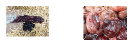 <p><u>Aetiology:</u> Acute and highly fatal enterotoxaemic disorder caused by</p><ol><li><p><em>Clostridium perfringens</em> type A</p></li><li><p><em>Aspergillus fumigatus </em>mycotoxin</p></li></ol><p><u>Pathogenesis:</u> Haemorrhaging bowel → Large blood clot obstructs intestinal lumen</p><p><u>Clinical Signs:</u></p><ol><li><p>Depressed, inappetence, dehydration</p></li><li><p>Decreased rumen motility</p></li><li><p>Sudden/severe drop in milk production</p></li><li><p>Succussible fluid with ballottement of right abdomen AND right-sided abdominal ping</p></li><li><p>Reduced to scant faecal production</p></li><li><p>Colic</p></li><li><p>Melaena and clotted blood in faeces (blackberry jam) → SCANT</p></li><li><p>Tachycardia</p></li></ol><p><u>Diagnosis:</u> U/S or exploratory laparotomy</p><p><u>Treatment:</u> </p><ol><li><p>Surgery = Laparotomy to find obstruction and break down clot</p></li></ol><ul><li><p>Do NOT open bowel → Generalised fibrinous peritonitis</p></li></ul><ol start="2"><li><p>Lignocaine CRI = Pro-kinetic and analgesia for 1 - 3d until faeces passed</p><ul><li><p>Loading dose 1.3mg/kg → CRI @ 0.05mg/kg/min</p></li></ul></li></ol><p><u>Prognosis:</u> 60% survival with surgery (100% mortality without treatment)</p>