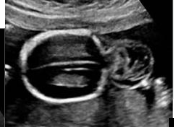 <p>What does this image represent?</p>