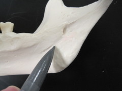 <p>Which part of the mandible is shown?</p>