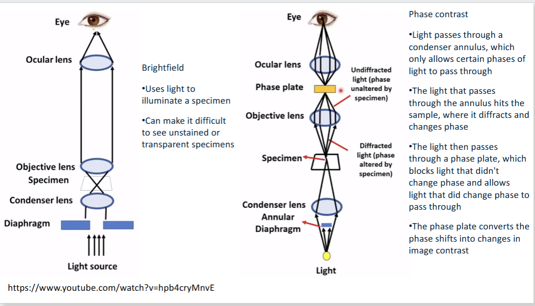 <p>Quantitative phase imaging (QPI) refers to a subset of label-free microscopy techniques where contrast in the image is generated by the variation of optical path length across the sample. The resulting image is a phase map that is a quantitative measure of the product of the difference between the refractive index of the tissue and that of its surrounding medium</p>