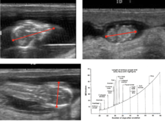 <p>When is crown rump length 20-21 cm and best for estimating of age?</p>