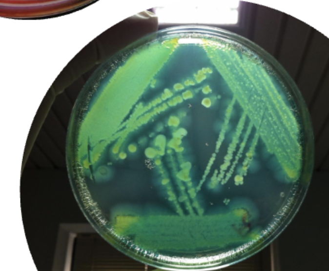 <ul><li><p>Smell: <strong>Grape or corn chips</strong></p></li><li><p>Texture: <strong>Metallic sheen</strong></p></li><li><p>Color: Pyocyanin and pyoverdin give <strong>GREEN</strong> color</p><ul><li><p>Pyorubin/melanin can also give <strong>BROWNish</strong> color too</p></li></ul></li></ul><p></p>