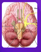 <p>what cranial nerve is highlighted in yellow?</p>