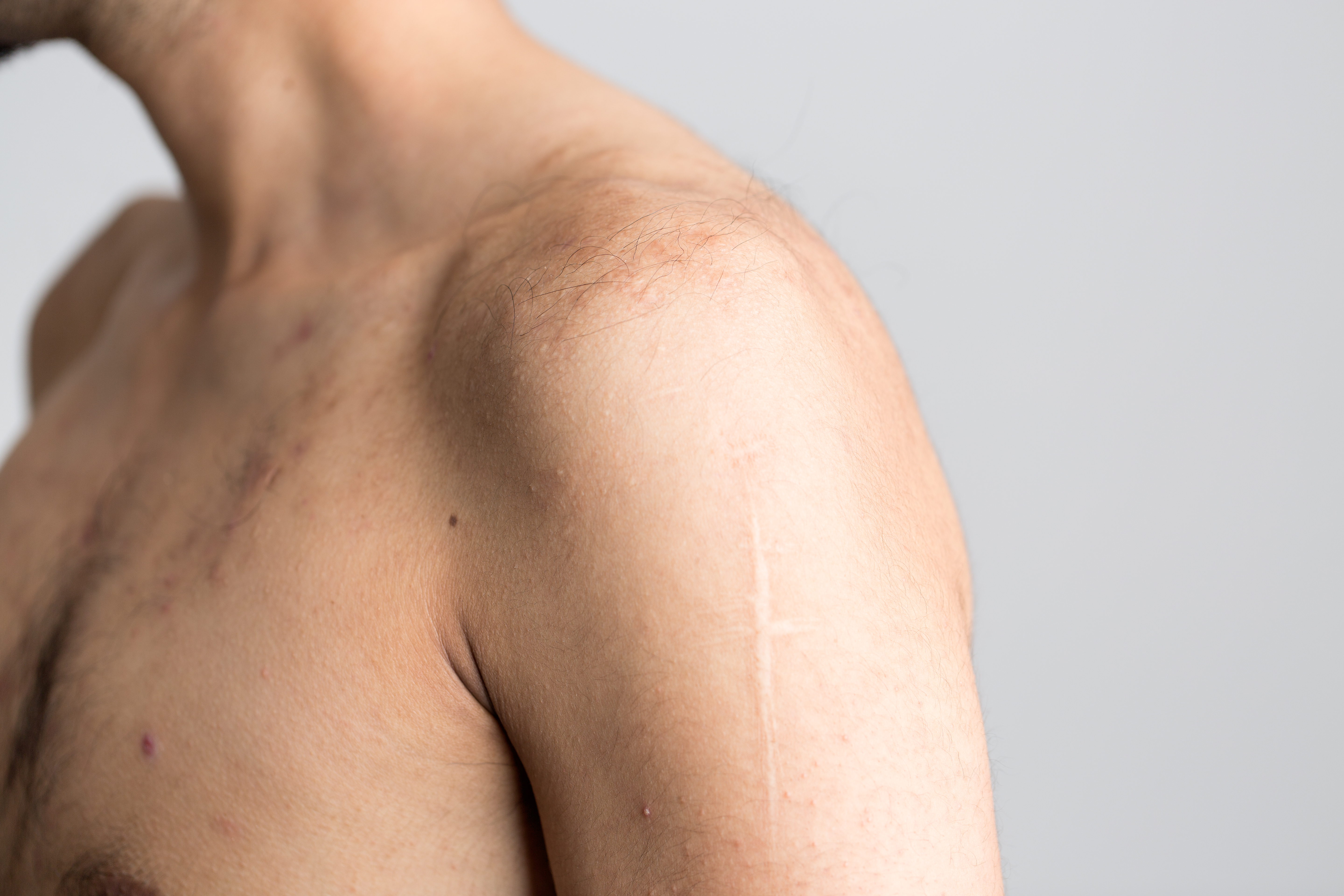 <p>shoulder \ keep shoulders down</p>