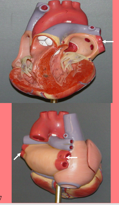 <p>carry</p><p>– Oxygenated blood from the lungs</p><p>– To the left atria</p><p>– Note –These veins carry oxygenated blood</p>