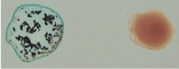 <p>What type of blood is this?</p>