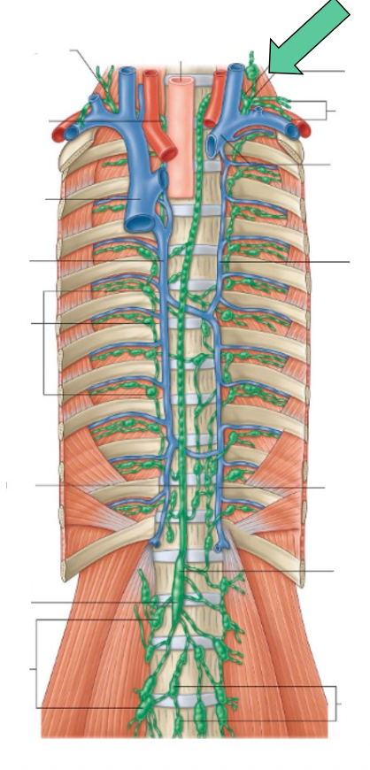 <p>Ganglion de Virchow (Troisier)</p>