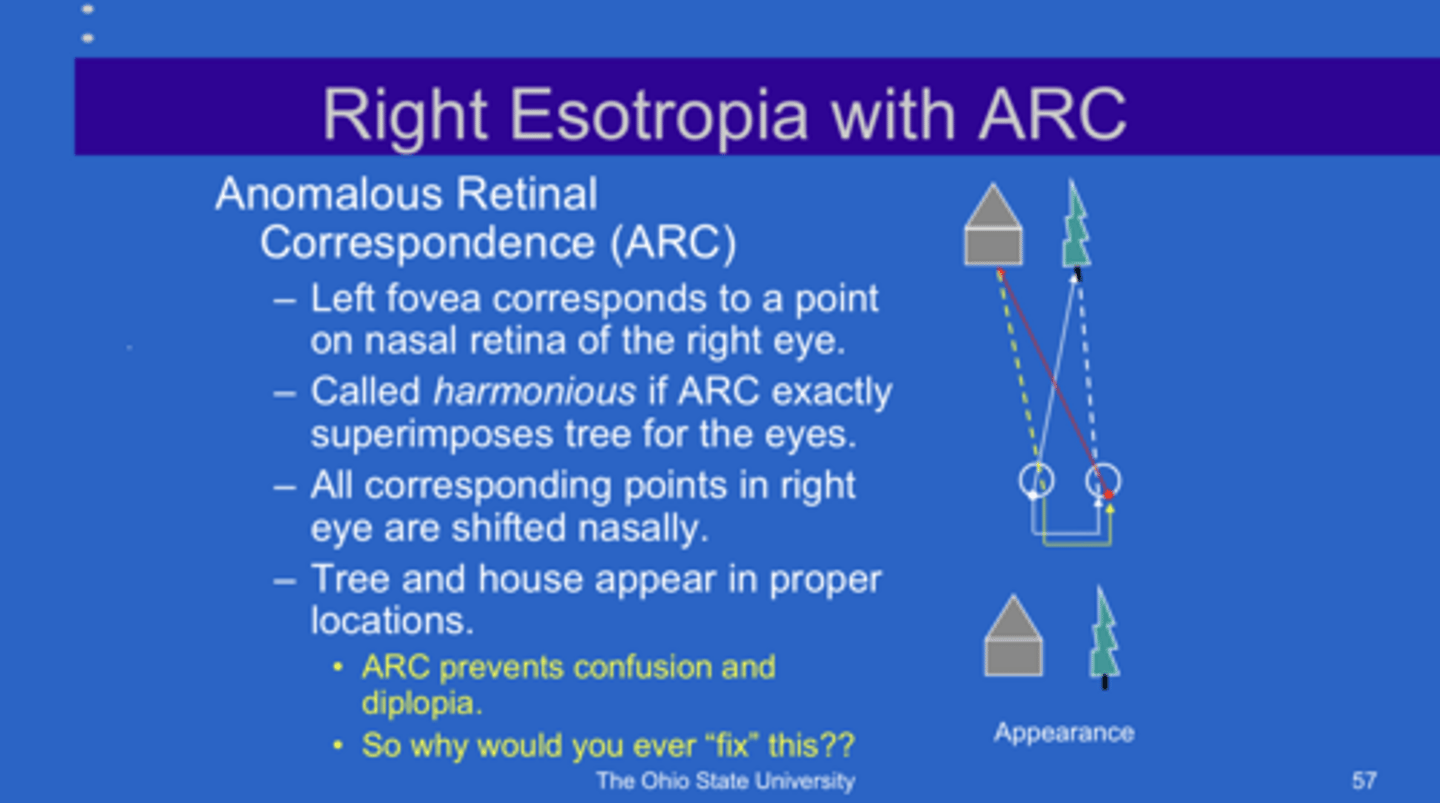 <p>If ARC EXACTLY superimposes the target for both eyes... what is this called?</p>
