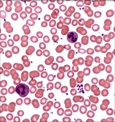 <p>red and white blood cells</p><p>White blood cells r bigger</p>