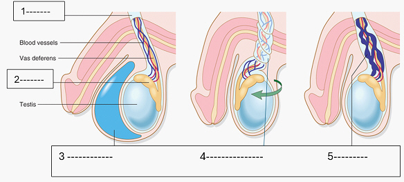 <p>3 (1-5) </p>