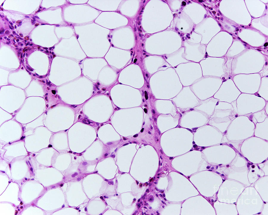 <p>Adipose Tissue </p>